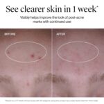 Neutrogena Evenly Clear Acne Cleanser with 2% Salicylic Acid & 2% PHA Exfoliant, Gentle Foaming Face Wash Clears Clogged Pores & Blackheads While Visibly Fading Look of Post-Acne Marks, 9.1 fl. oz - Image 8